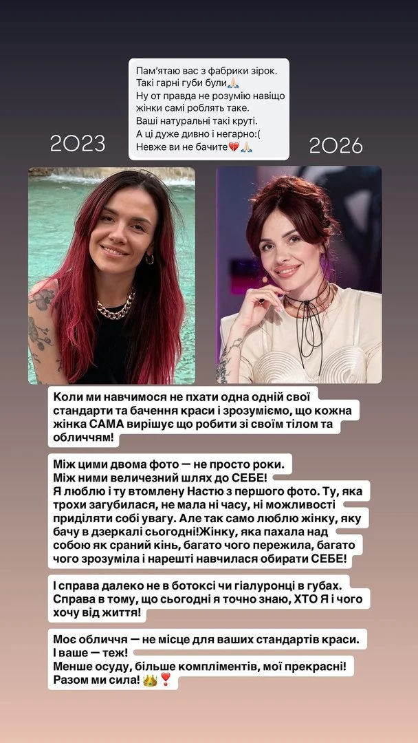 MamaRika до та після збільшення губ / © instagram.com/mamarika_official